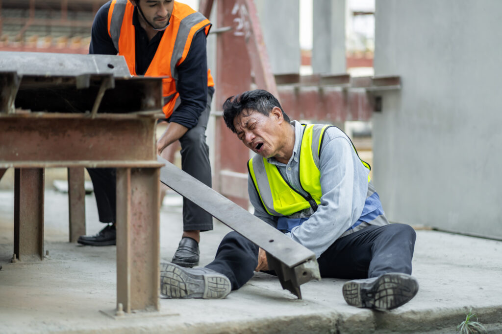 An engineer has an accident where steel falls on his leg at work